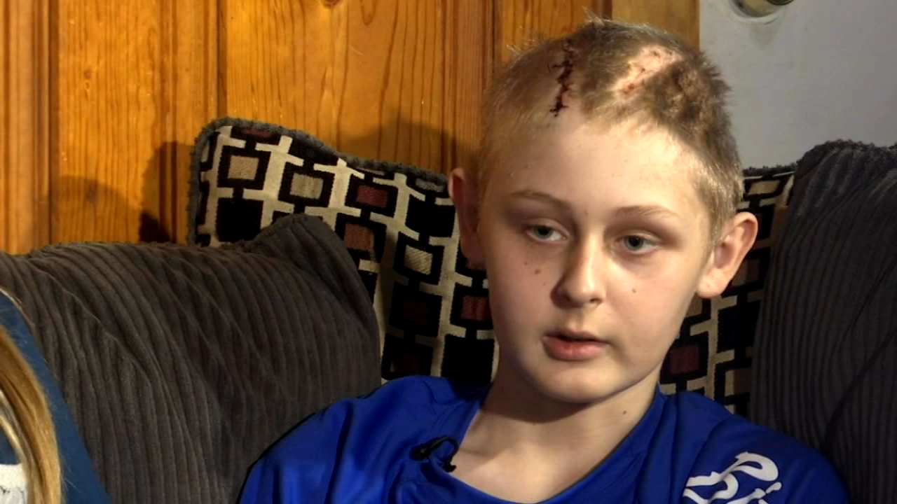 Miraculous Recovery for 13-year-old Declared 15 Minutes Brain Dead (ABC7)